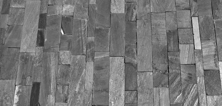 酸性磷酸酶檢測(cè)