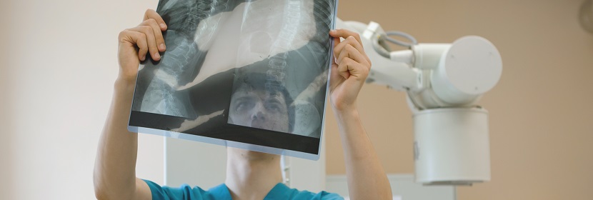 移動(dòng)CR放射衛(wèi)生檢測評價(jià)