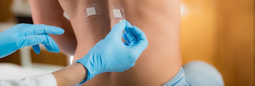 皮膚光變態反應試驗