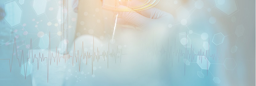 三聚氰胺改性脲醛樹脂檢測